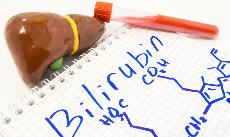 What are the causes of high bilirubin: Symptoms, causes and treatment